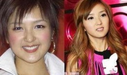 爆料娱乐圈没整容明星女,揭秘未整容的清新女神